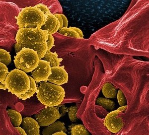 腸内細菌の種類によって薬剤の効果が変わってくることが判明! (nature誌2019年6月)